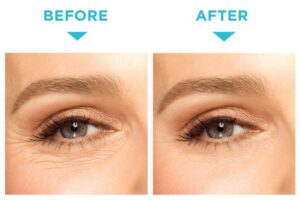 Instantly Ageless® in Cape Town